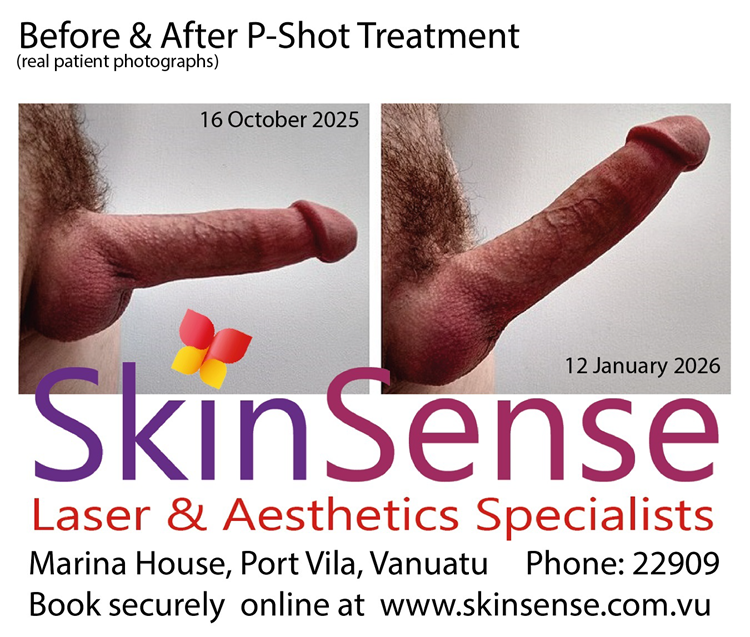 Before and after PShot Photograpghs